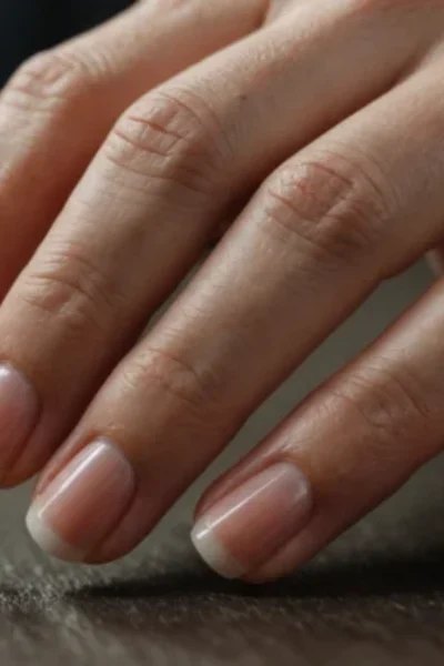 ongles striés