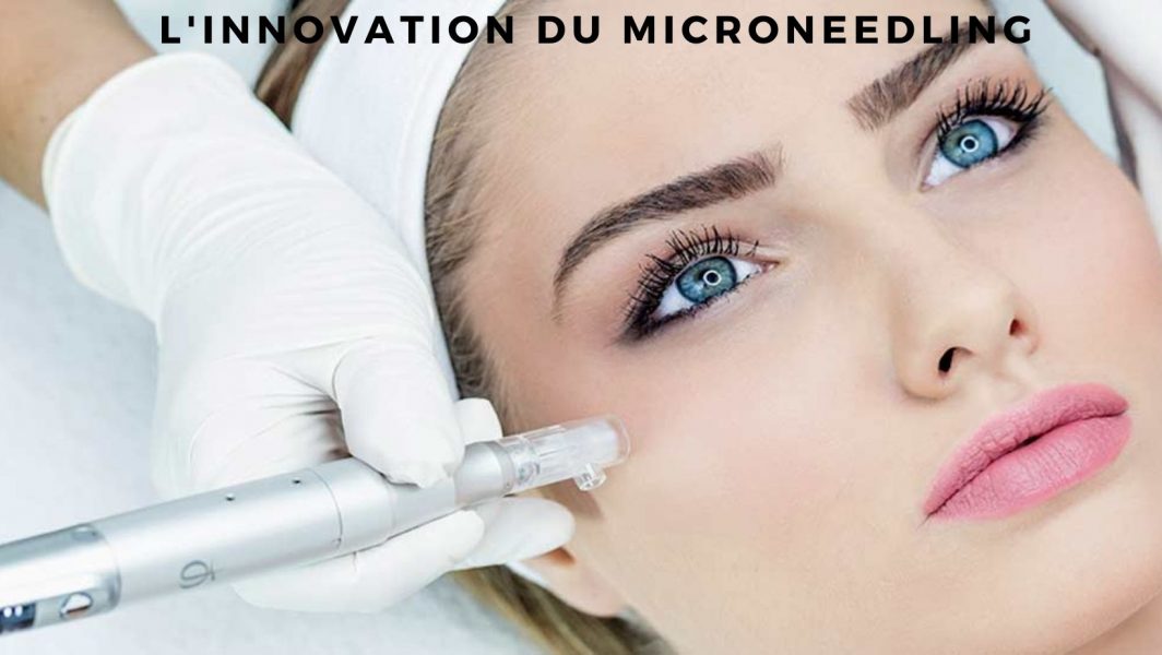 Microneedling