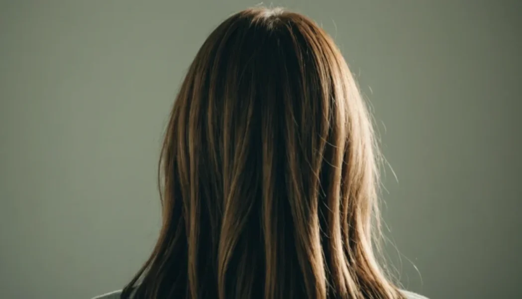 psoriasis cheveux